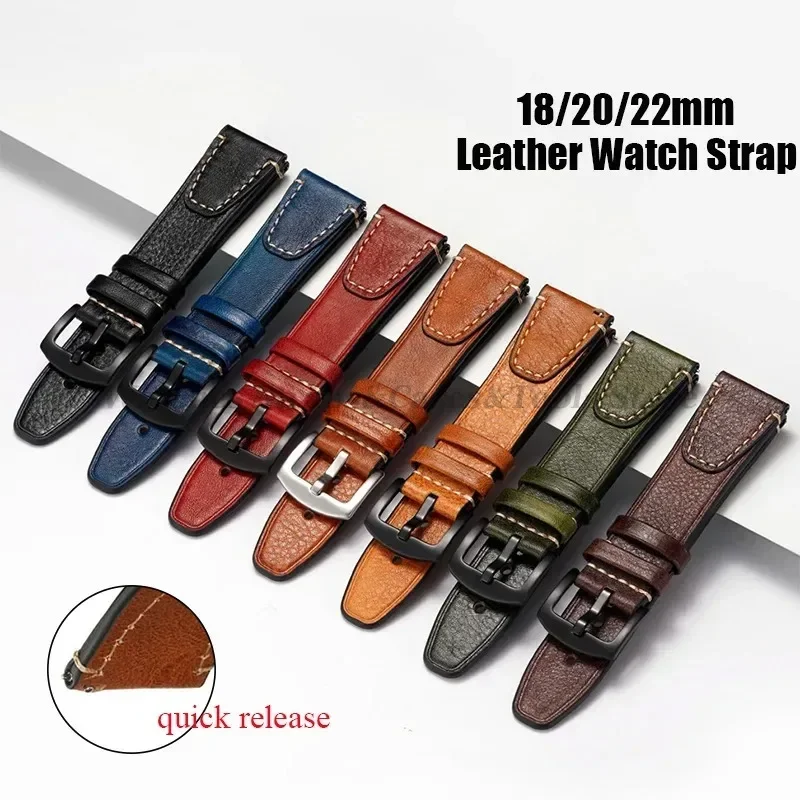 Universal Retro Watchband for  - đánh giá và giá Watches Rolex Smartwatch